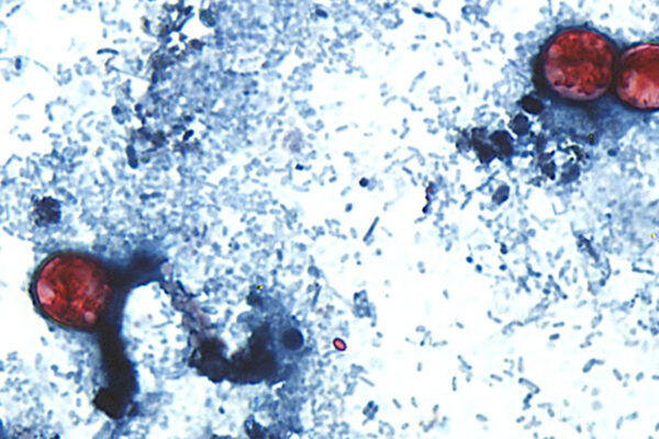 Cyclospora parazitiyle mücadelede perde arkası.