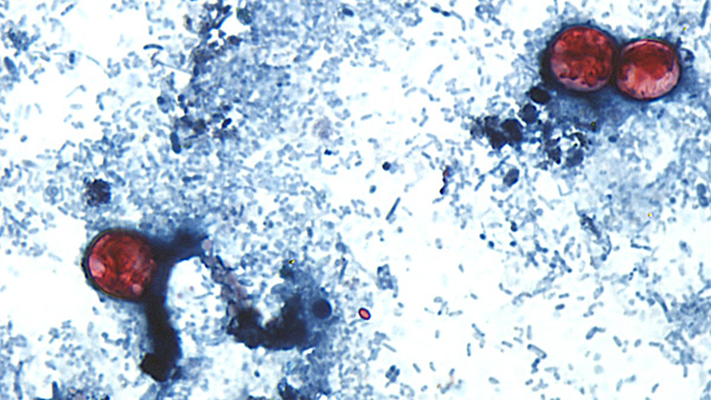 Cyclospora parazitiyle mücadelede perde arkası.