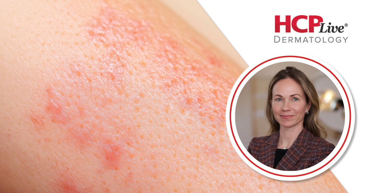 Güneş Kremi Hakkındaki Yanlış Bilgiler Nelerdir? Dermatolog Kathleen Suozzi Açıklıyor.