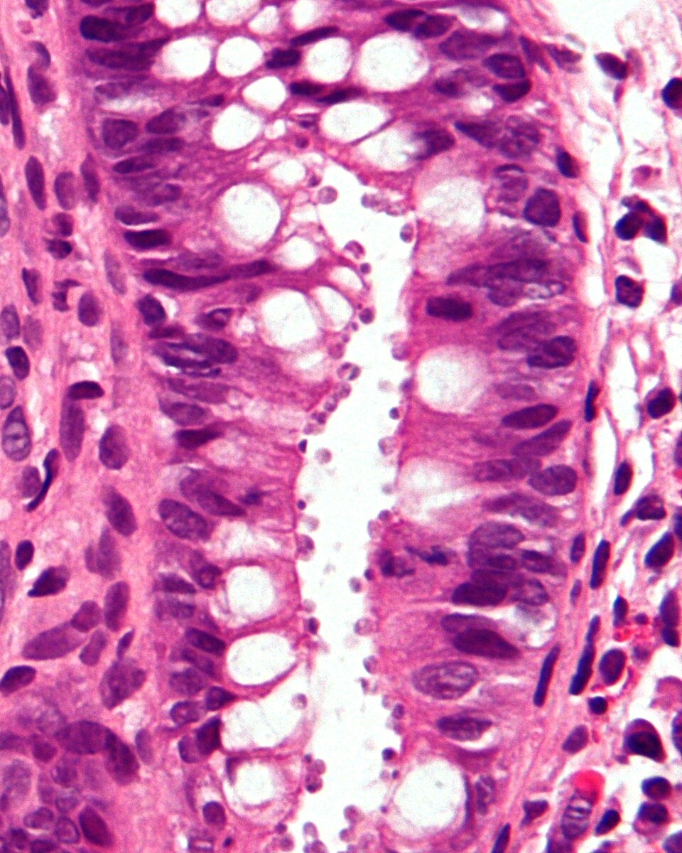 Cyprosporiasis illustration