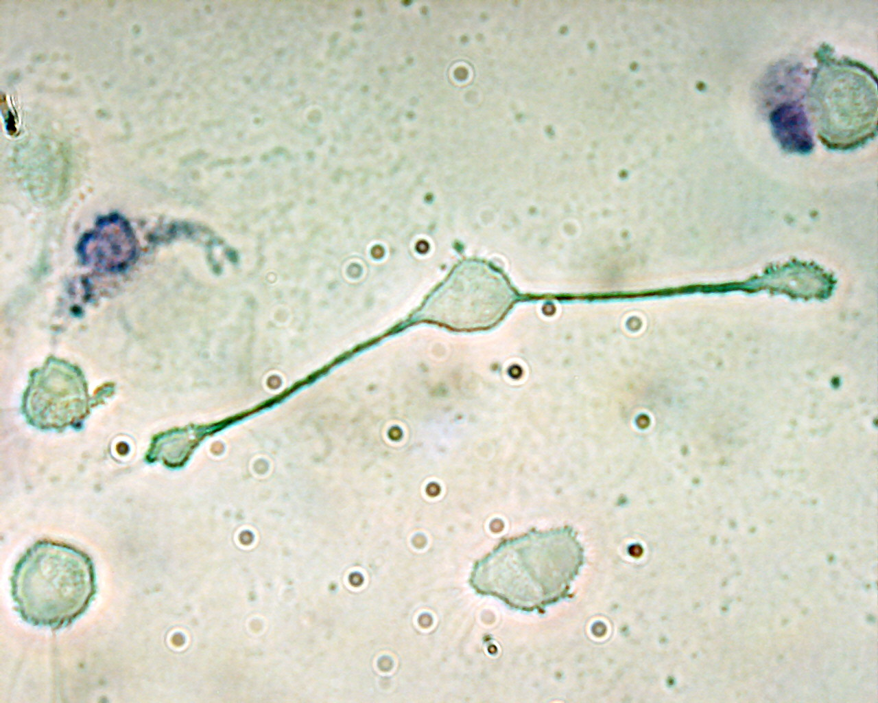 A macrophage of a mouse forming two processes to phagocytize two smaller particles, possibly path...