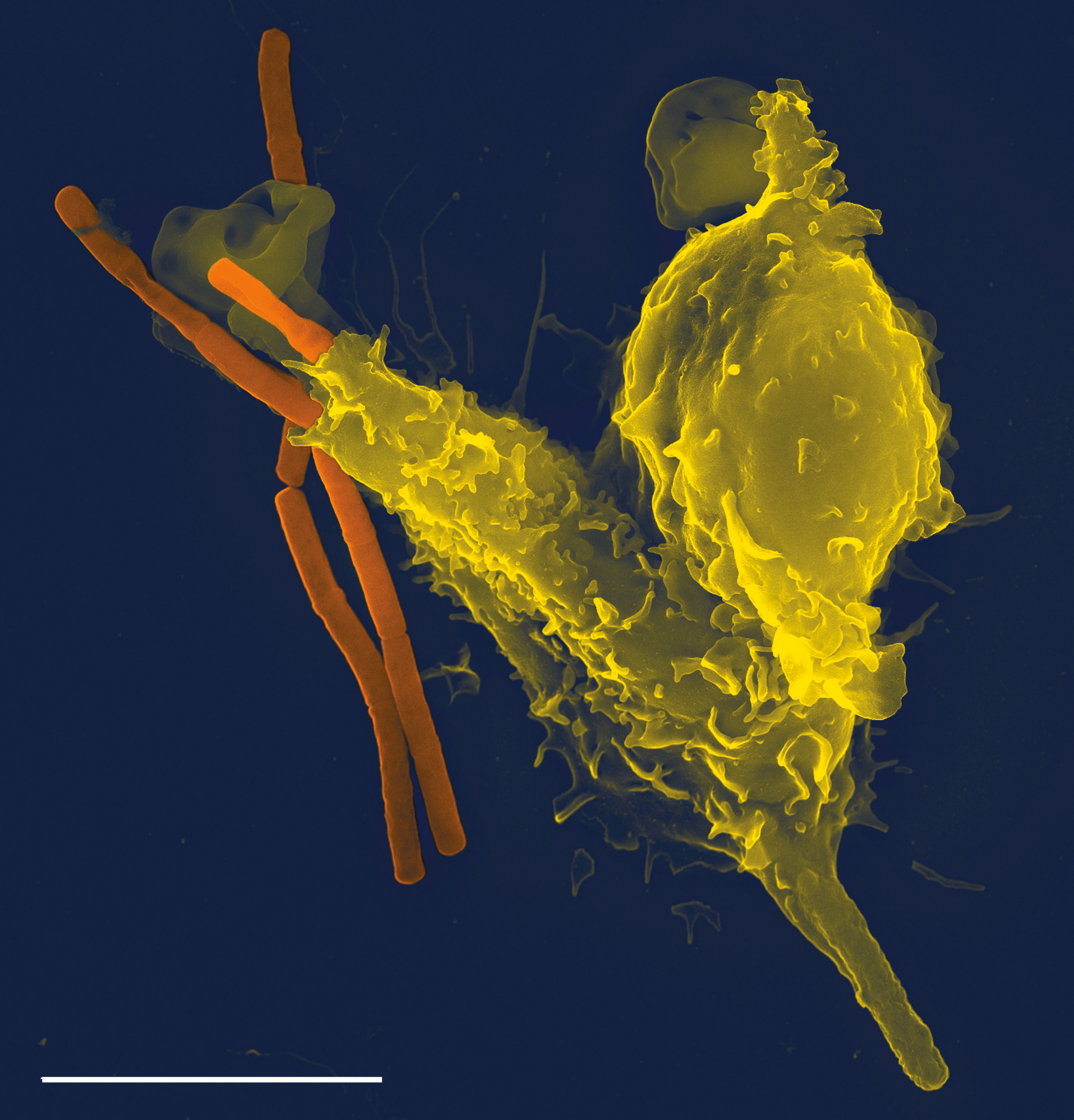 Neutrophil engulfing anthrax bacteria, taken with a Leo 1550 scanning electron microscope.  Scale...