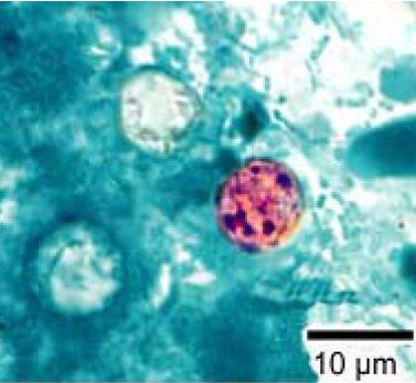 Cyclospora Nedir?