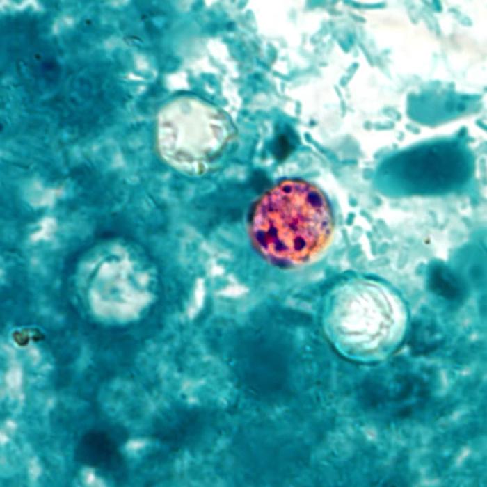 Cyclosporiasis Nedir?