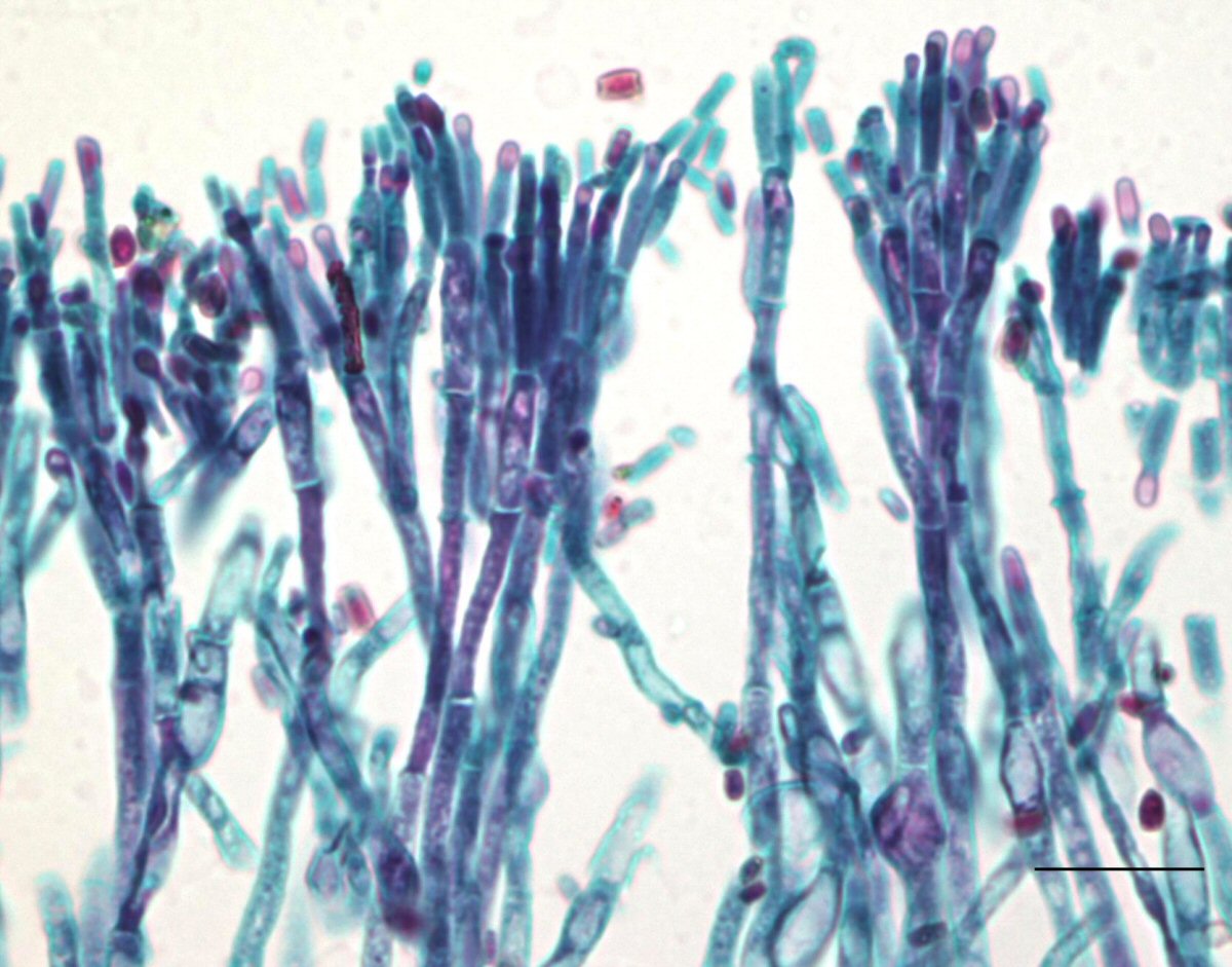 Light microscopy of Penicillium with conidiophores bearing conidia (asexual spores). Scale bar = ...