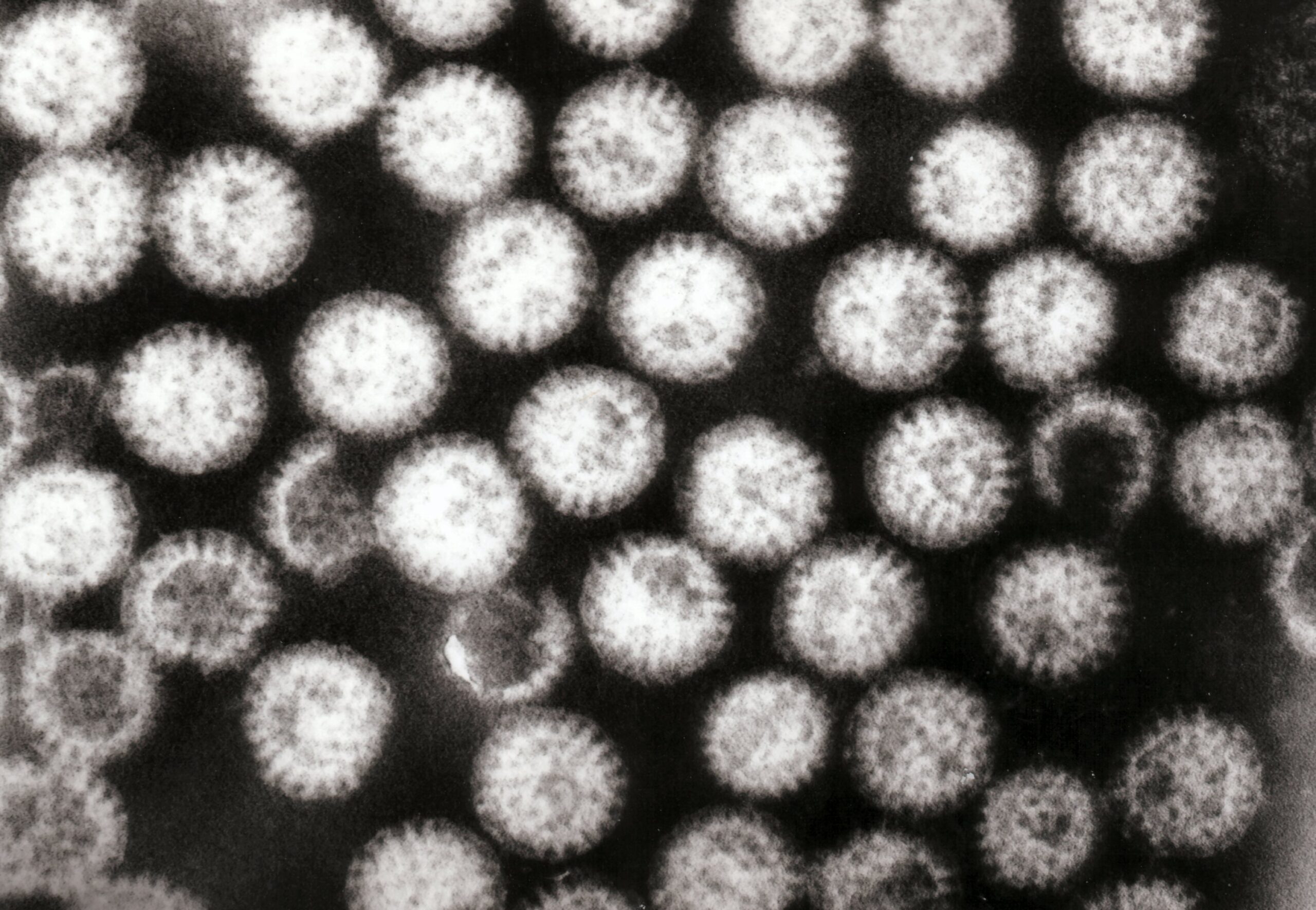 Taramalı elektron mikroskobu ile görüntülenen, her biri yaklaşık 70 nanometre boyutundaki çok sayıda rotavirüs parçacığı.