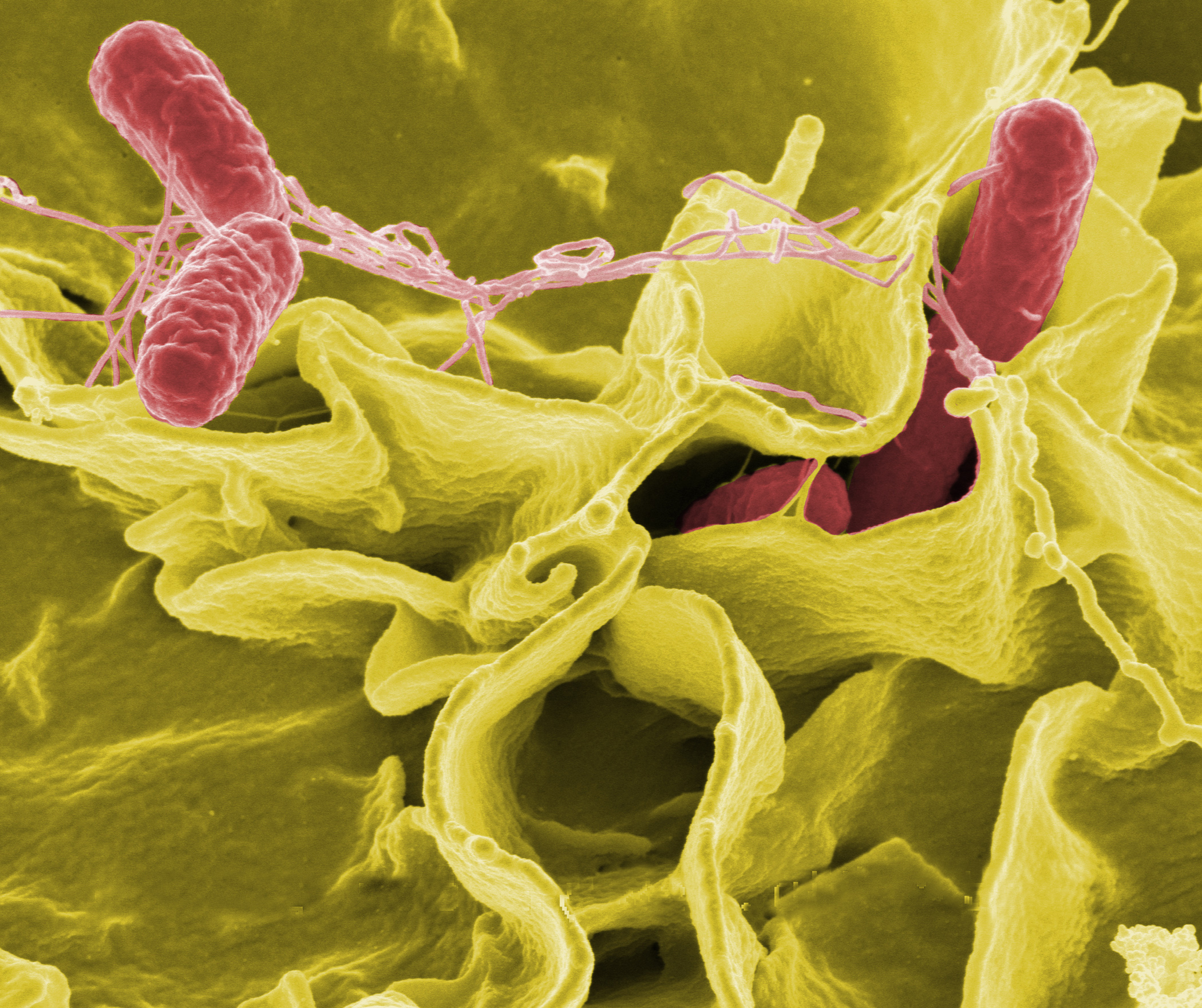 Renk iyileştirmeli taramalı elektron mikroskobu görüntüsü; kültürün içine nüfuz eden Salmonella Typhimurium (kırmızı).