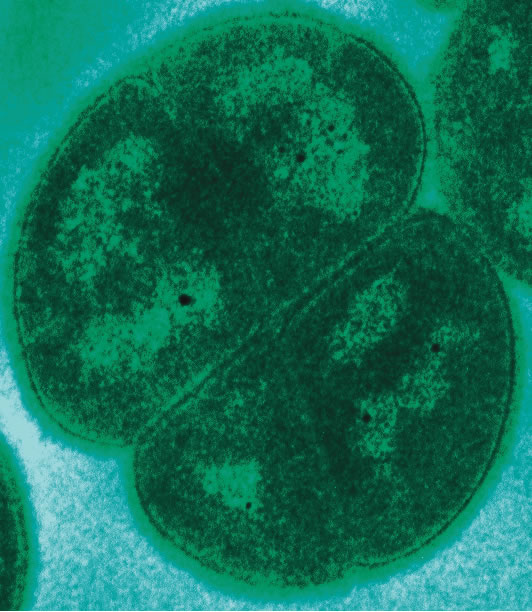 Deinococcus radiodurans’un transmisyon elektron mikroskobu (TEM) görüntüsü; uç koşullardaki biyolojik direncini ve yaşamın dayanıklılığını simgelemektedir.